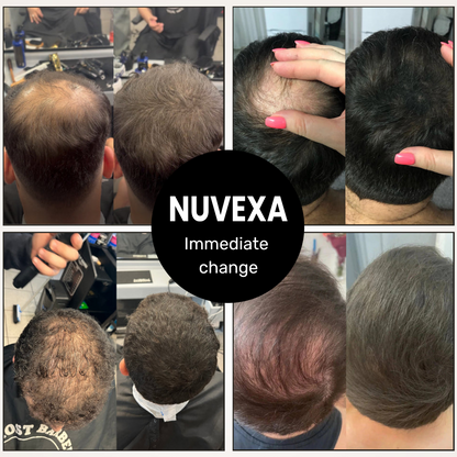 Nuvexa Powder — #1 for concealing bald spots
